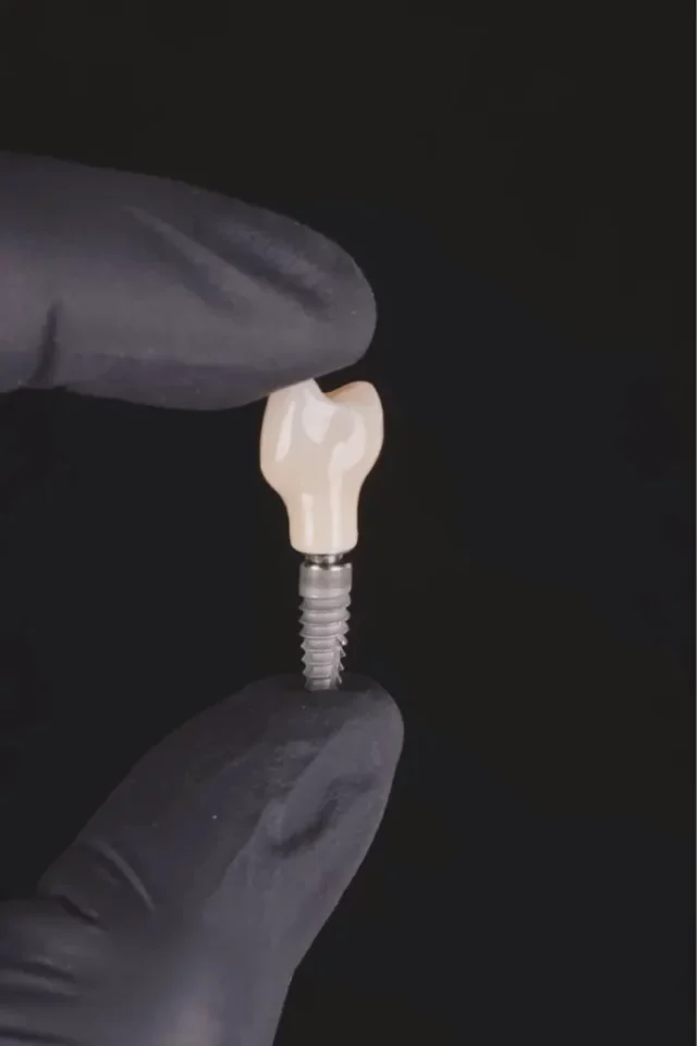 Maquette d’un implant dentaire et de sa couronne